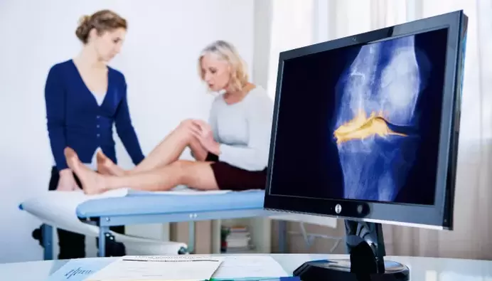 Arthrose des Gelenks bei einer Frau.